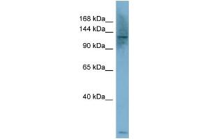 WB Suggested Anti-PLCB1  Antibody Titration: 0. (Phospholipase C beta 1 Antikörper  (Middle Region))