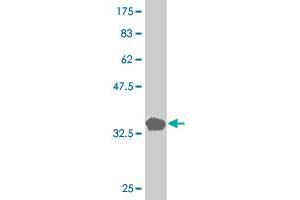 Western Blot detection against Immunogen (36. (LIM Domain Kinase 1 Antikörper  (AA 548-647))