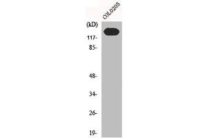 Western Blot analysis of C0L0205 cells using N-cadherin Polyclonal Antibody (N-Cadherin Antikörper  (C-Term))