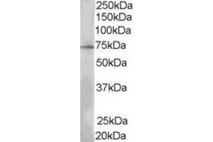 Western Blotting (WB) image for anti-SH2B Adaptor Protein 3 (SH2B3) (N-Term) antibody (ABIN2465907) (SH2B3 Antikörper  (N-Term))