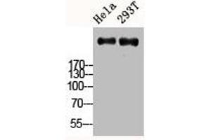 Western Blot analysis of HELA 293T cells using Ki-67 Polyclonal Antibody (Ki-67 Antikörper  (C-Term))