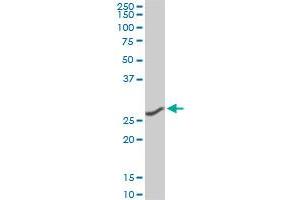 CNOT7 monoclonal antibody (M01A), clone 2F6. (CNOT7 Antikörper  (AA 1-285))