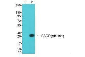 Western blot analysis of extracts from A549 cells (Lane 2), using FADD (Ab-191) antiobdy. (FADD Antikörper  (C-Term))