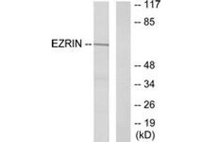 Western blot analysis of extracts from A431 cells, treated with EGF 200ng/ml 30', using Ezrin (Ab-353) Antibody. (Ezrin Antikörper  (AA 321-370))