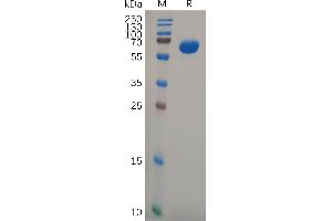 Human Protein, hFc Tag on SDS-PAGE under reducing condition. (GPA33 Protein (AA 22-235) (Fc Tag))