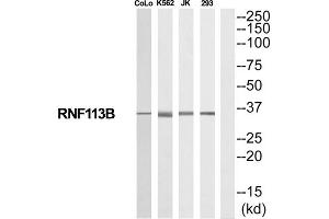 Western Blotting (WB) image for anti-Ring Finger Protein 113B (RNF113B) (Internal Region) antibody (ABIN1852492) (RNF113B Antikörper  (Internal Region))