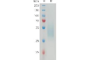 Mouse B7-H4 Protein, His Tag on SDS-PAGE under reducing condition. (VTCN1 Protein (AA 29-256) (His tag))