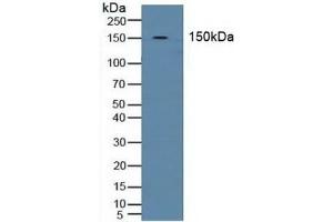 Detection of BND3 in Human Blood Cells using Polyclonal Antibody to Band 3 (BND3) (Band 3/AE1 Antikörper  (AA 35-290))