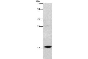 Western Blot analysis of Mouse stomach tissue using GRP Polyclonal Antibody at dilution of 1:1000 (Gastrin-Releasing Peptide Antikörper)