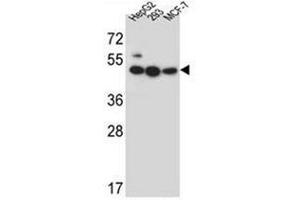 Western blot analysis of LIPJ Antibody (Center) in HepG2, 293, MCF-7 cell line lysates (35ug/lane). (LIPJ Antikörper  (Middle Region))