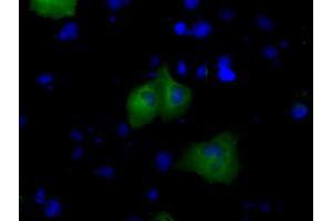 Immunofluorescence (IF) image for anti-Bruton Agammaglobulinemia tyrosine Kinase (BTK) antibody (ABIN1496977) (BTK Antikörper)
