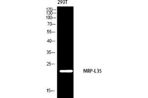 Western blot analysis of 293 using MRP-L35 antibody. (MRPL35 Antikörper  (AA 80-160))