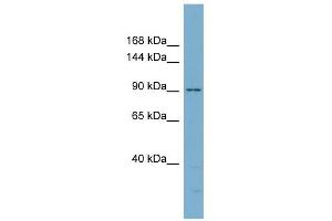 Catenin antibody used at 1 ug/ml to detect target protein. (Catenin Antikörper)