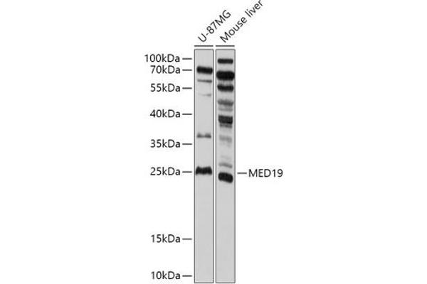 MED19 Antikörper  (AA 60-160)