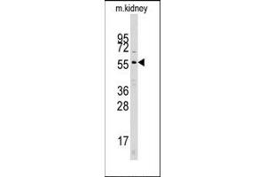 Image no. 1 for anti-Cell Division Cycle 25 Homolog A (S. Pombe) (CDC25A) (N-Term) antibody (ABIN358770) (CDC25A Antikörper  (N-Term))