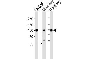 Western blot analysis of lysates from LNCaP, M. (MME Antikörper  (N-Term))