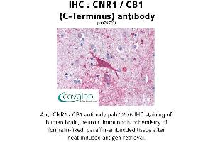 Image no. 1 for anti-Cannabinoid Receptor 1 (CNR1) (C-Term) antibody (ABIN1733176) (CNR1 Antikörper  (C-Term))