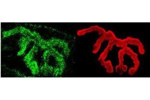 Piccolo Immunofluorescence. (PCLO Antikörper)