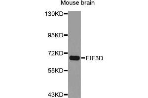 Western Blotting (WB) image for anti-Eukaryotic Translation Initiation Factor 3, Subunit D (EIF3D) antibody (ABIN1876976) (EIF3D Antikörper)