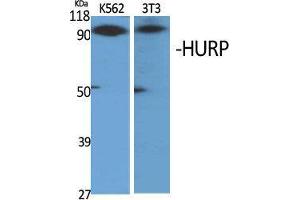 Western Blot (WB) analysis of specific cells using HURP Polyclonal Antibody. (DLGAP5 Antikörper  (C-Term))
