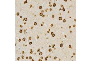 Immunohistochemistry (Paraffin-embedded Sections) (IHC (p)) image for anti-Lamin A/C (LMNA) (AA 403-572) antibody (ABIN3020785)