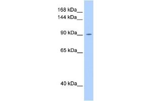 WB Suggested Anti-OSMR Antibody Titration:  0. (Oncostatin M Receptor Antikörper  (N-Term))