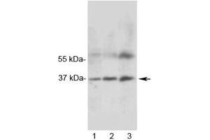 Western blot testing of 1) rat heart, 2) rat skeletal muscle and 3) human MCF7 lysate with MRGX1 antibody. (MRGPRX1 Antikörper)