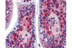 SSX2IP antibody was used for immunohistochemistry at a concentration of 4-8 ug/ml. (SSX2IP Antikörper  (Middle Region))