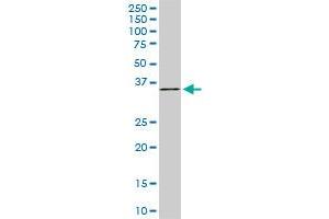 Western Blotting (WB) image for anti-Four and A Half LIM Domains 1 (FHL1) (AA 23-120) antibody (ABIN560899)