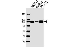 Lane 1: MCF-7 Cell lysates, Lane 2: Sample Tissue/Cell lysates, Lane 3: PC-12 Cell lysates, probed with TOP1 (1291CT875. (Topoisomerase I Antikörper)