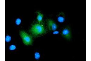 Image no. 2 for anti-Baculoviral IAP Repeat-Containing 5 (BIRC5) antibody (ABIN1501247) (Survivin Antikörper)