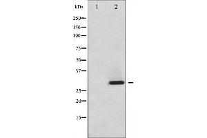 Western blot analysis of ATF1 phosphorylation expression in Insulin treated HT29 whole cell lysates,The lane on the left is treated with the antigen-specific peptide. (AFT1 Antikörper  (pSer63))