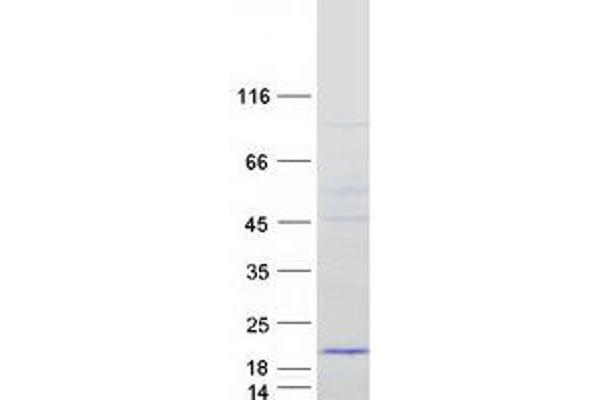 MRPS16 Protein (Myc-DYKDDDDK Tag)