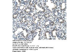 Human Lung (SLC43A3 Antikörper  (N-Term))