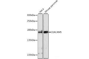 Western blot analysis of extracts of various cell lines using CEACAM5 Polyclonal Antibody at dilution of 1:1000. (CEACAM5 Antikörper)