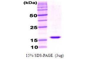 SDS-PAGE (SDS) image for Adiponectin (ADIPOQ) (AA 111-247) protein (ABIN666808) (ADIPOQ Protein (AA 111-247))