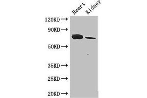 Western Blot Positive WB detected in: Mouse heart tissue, Mouse kidney tissue All lanes: MED17 antibody at 2. (MED17 Antikörper  (AA 411-651))