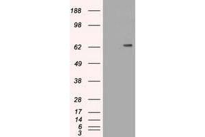 HEK293T cells were transfected with the pCMV6-ENTRY control (Left lane) or pCMV6-ENTRY CD19 (Right lane) cDNA for 48 hrs and lysed. (CD19 Antikörper)