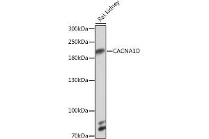 Western blot analysis of extracts of Rat kidney, using CD Rabbit pAb (ABIN7266013) at 1:1000 dilution. (CACNA1D Antikörper  (AA 1882-2181))