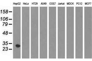 Western blot analysis of extracts (35 µg) from 9 different cell lines by using anti-SULT2A1 monoclonal antibody. (SULT2A1 Antikörper)