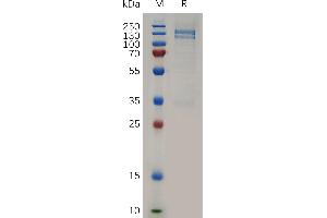 MST1R Protein (AA 25-957) (Fc Tag)