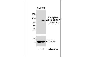 Western blot analysis of extracts from S cells, untreated or treated with Calyculin A, (100nM, 30 min), using Phospho-beta-catenin (Ser33/37) Antibody. (beta Catenin Antikörper  (pSer33, pSer37))