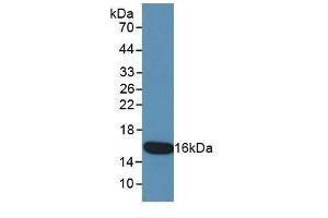 Detection of Recombinant KRT15, Human using Monoclonal Antibody to Cytokeratin 15 (CK15) (KRT15 Antikörper  (AA 274-399))