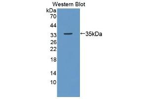 Detection of Recombinant Ki67P, Mouse using Polyclonal Antibody to Ki-67 Protein (Ki-67) (Ki-67 Antikörper  (AA 1-247))