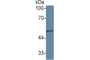 Western Blotting (WB) image for Heparanase (HPSE) ELISA Kit (ABIN6574194)