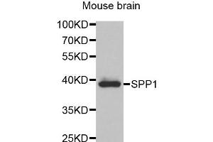 Western blot analysis of extracts of Mouse brain tissue, using SPP1 antibody. (Osteopontin Antikörper)