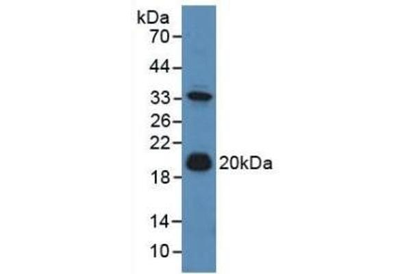 Adrenomedullin Antikörper  (AA 24-171)