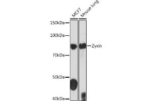 Western blot analysis of extracts of various cell lines, using Zyxin Rabbit mAb (ABIN1682627, ABIN3015962, ABIN3015963 and ABIN7101467) at 1:1000 dilution. (ZYX Antikörper)