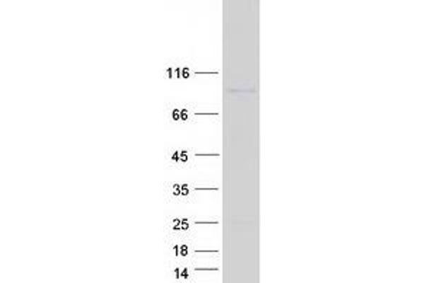 Junctophilin 4 Protein (JPH4) (Myc-DYKDDDDK Tag)