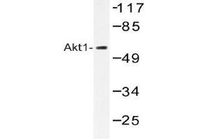 Western blot (WB) analysis of Akt1 antibody in extracts from HepG2 cells. (AKT1 Antikörper)